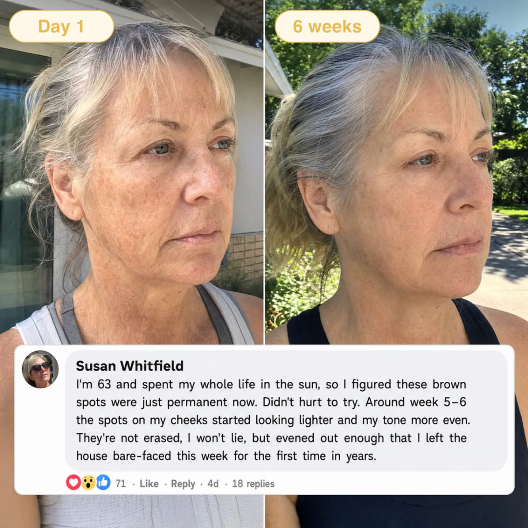 Serolla Turmeric & Kojic Acid Overnight Mask