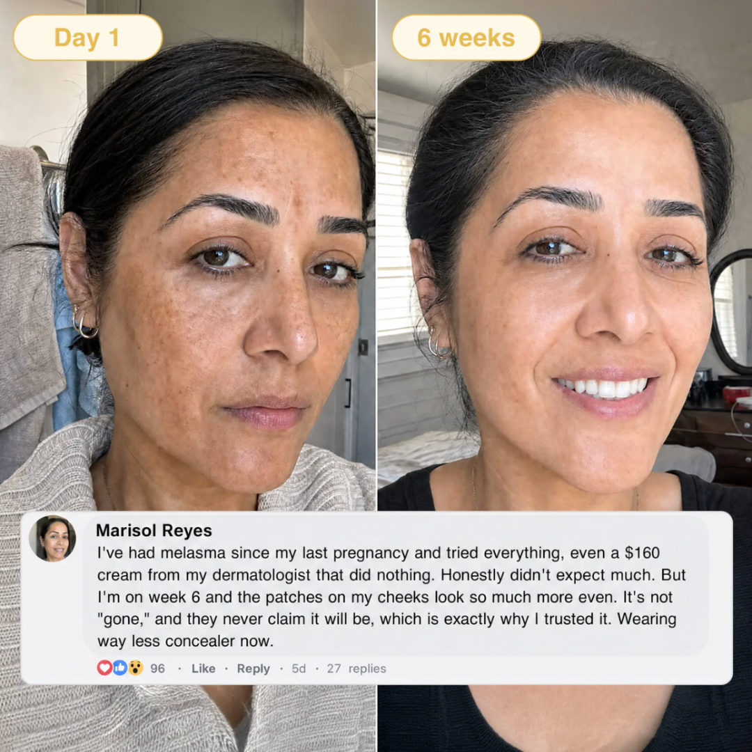 Serolla Turmeric & Kojic Acid Overnight Mask
