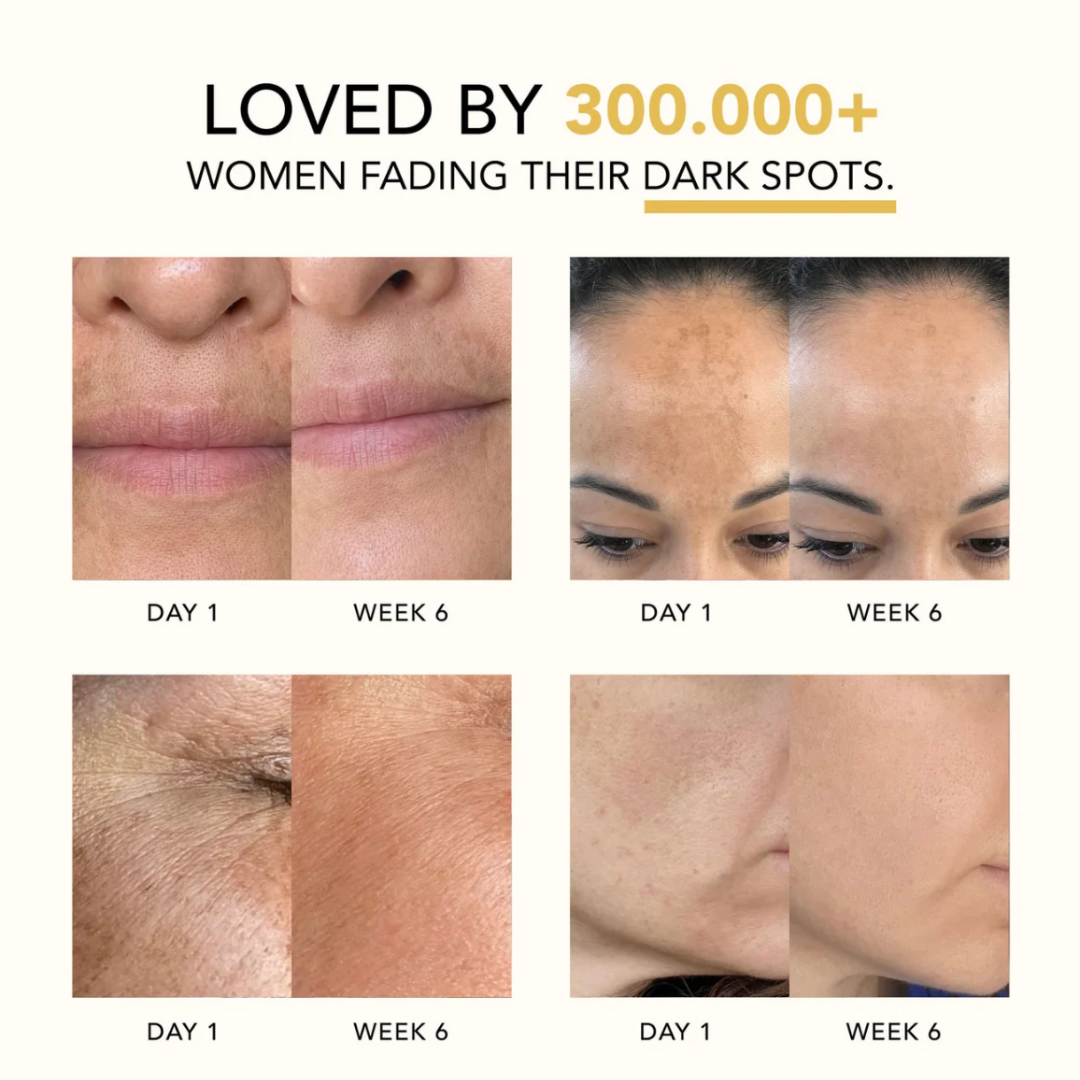 Serolla Turmeric & Kojic Acid Overnight Mask